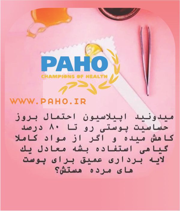 اپیلاسیون