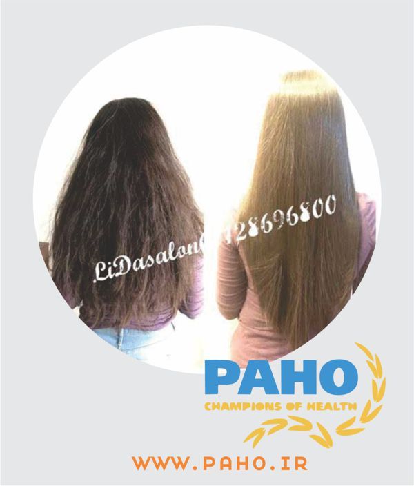 صافی ریباندینگ کرج