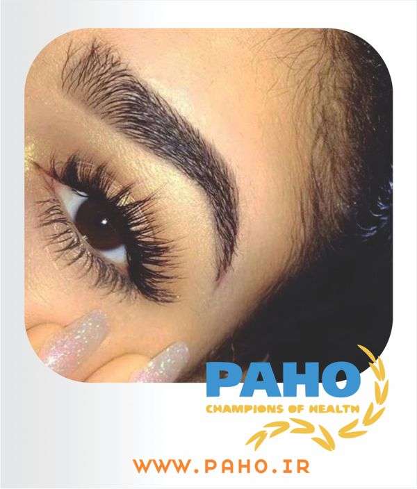 کاشت مژه کرج