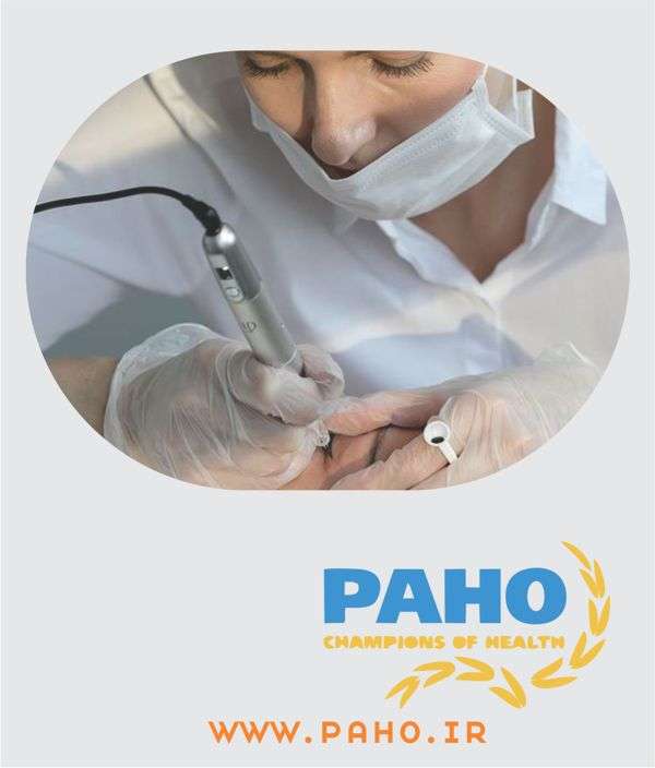 ریموو تاتو ابرو در اصفهان