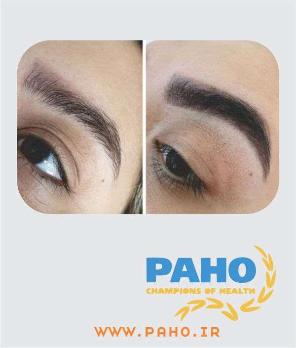 حنای ابرو