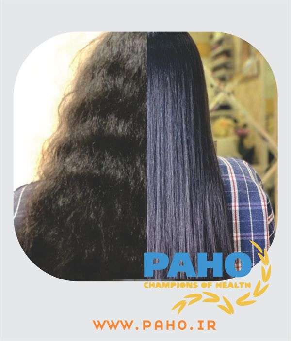 عوارض و مزایای ریباندینگ مو