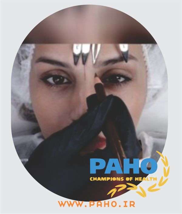 بهترین مرکز تاتو ابرو در یزد