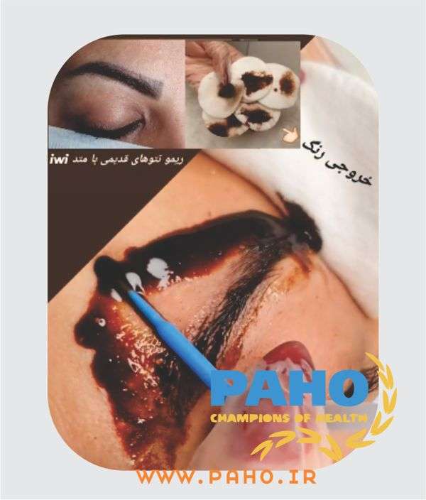 پاک کردن تاتو ابرو یزد