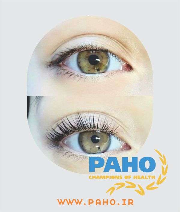 بهترین مرکز لیفت و لمینت مژه کرج