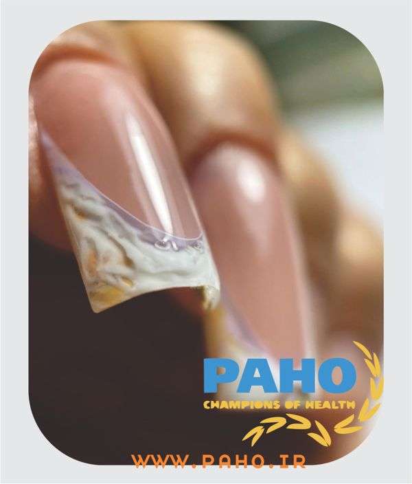 کاشت ناخن کیانپارس