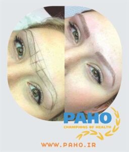 بهترین ابرو کار در فردیس
