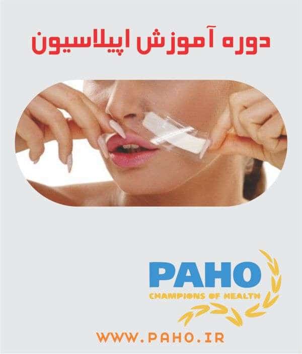 آموزش اپیلاسیون