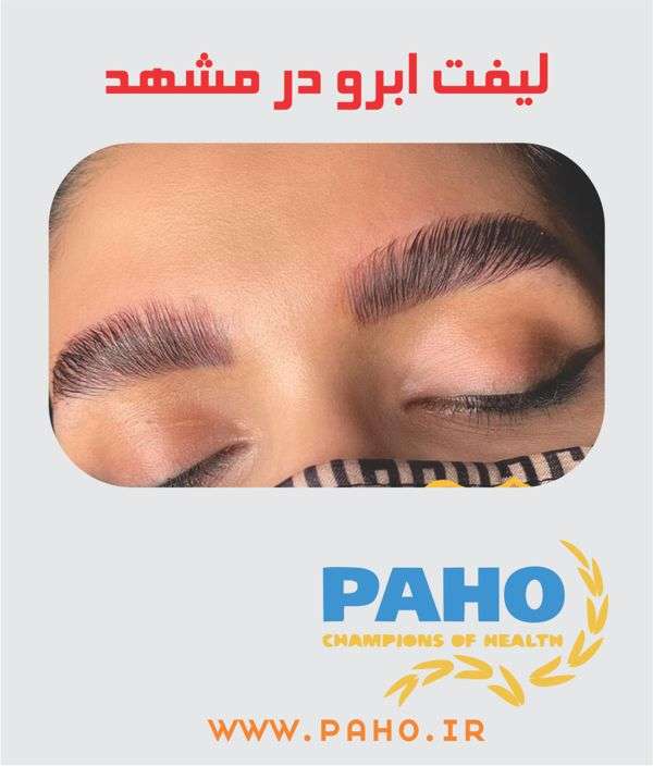 لیفت ابرو در مشهد