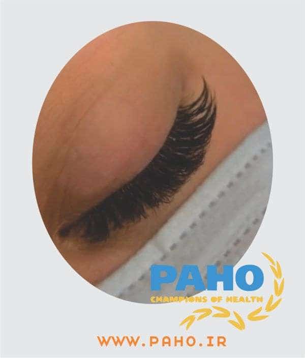 اکستنشن مژه در فردیس