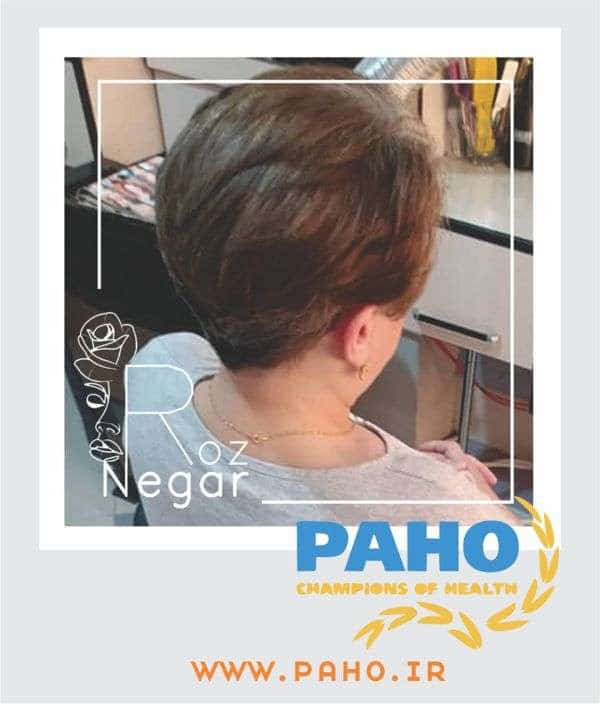کوتاهی مو در فردیس