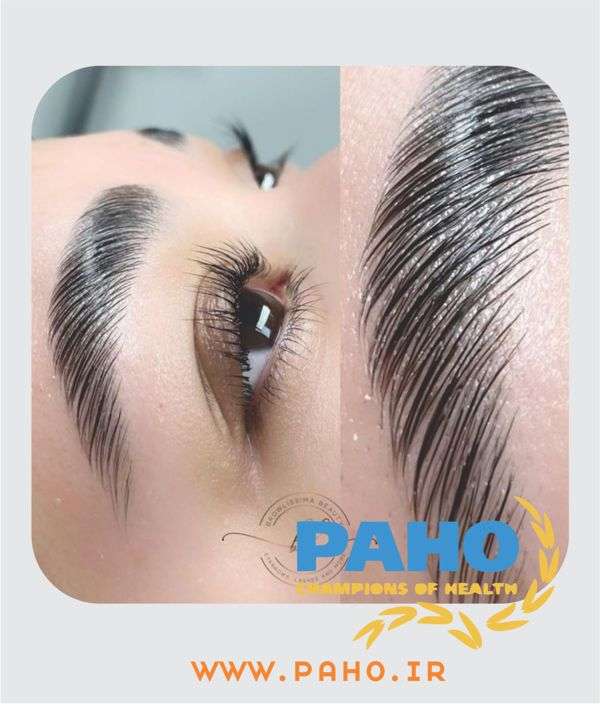 تفاوت لیفت و لمینت ابرو