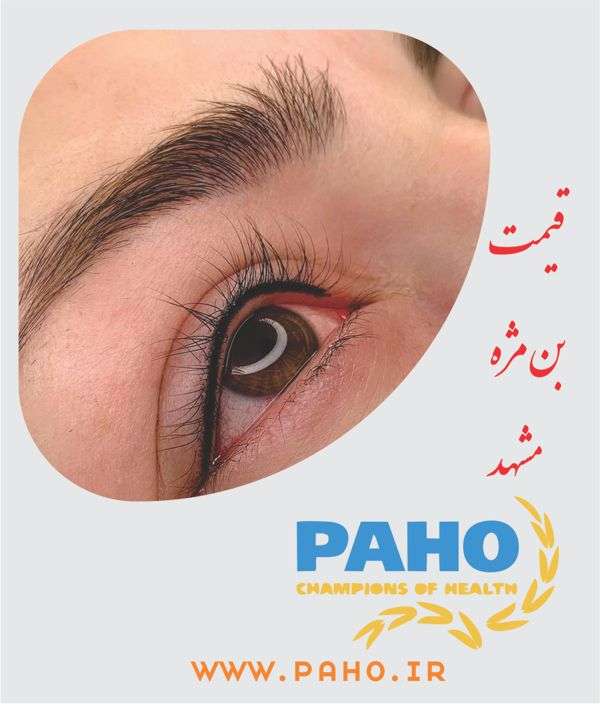 قیمت بن مژه در مشهد