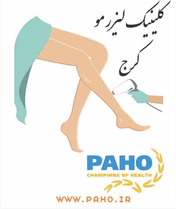لیزر مو در کرج