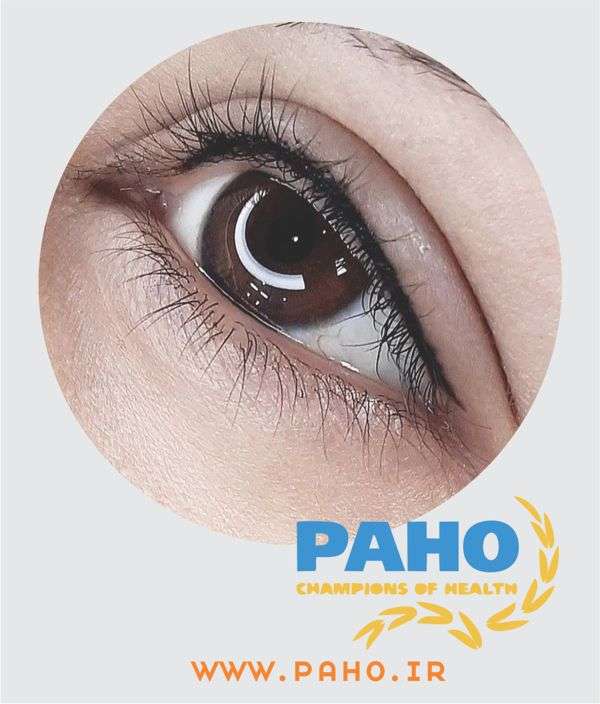 قیمت بن مژه در شیراز