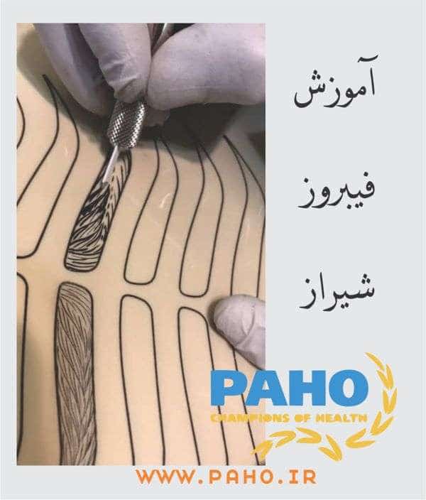 آموزش فیبروز شیراز