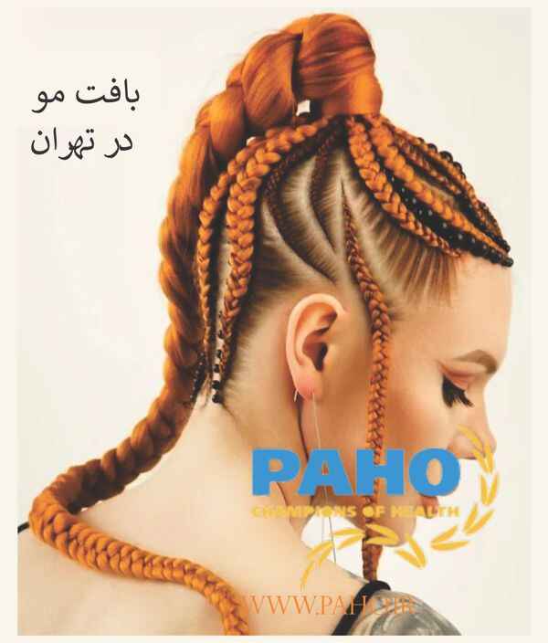 بافت مو در تهران