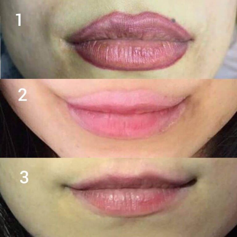 پاک کردن تتولب