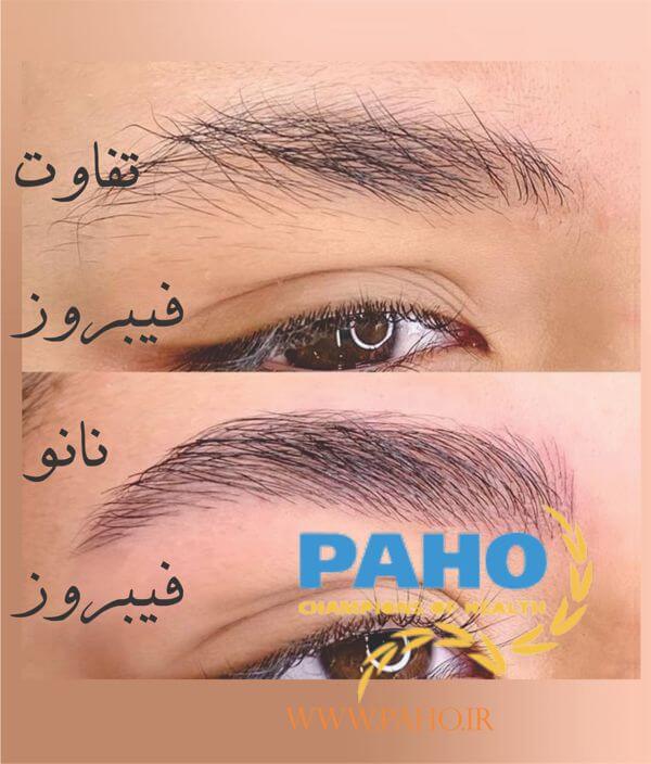 نمونه کار نانو فیبروز طبیعی
