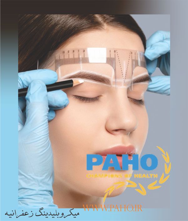 میکروبلیدینگ زعفرانیه