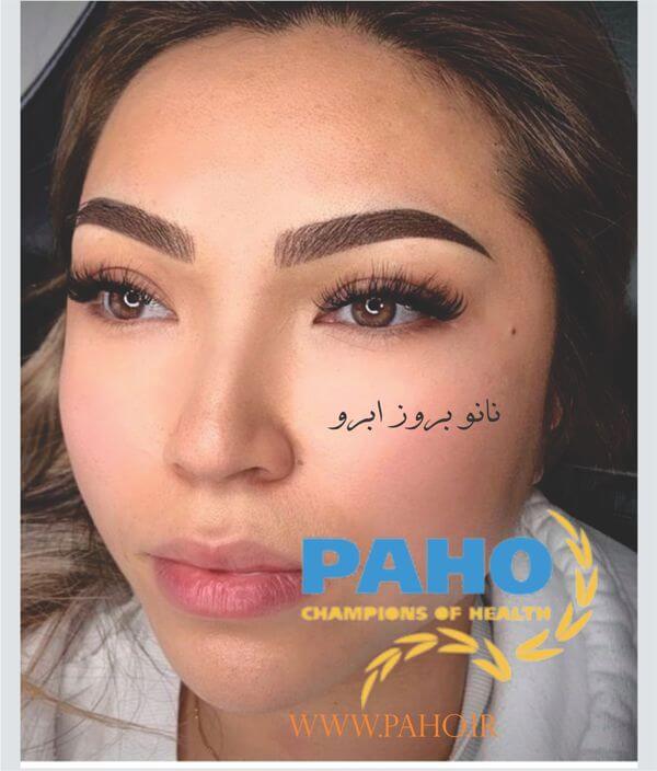 نانو بروز ابرو