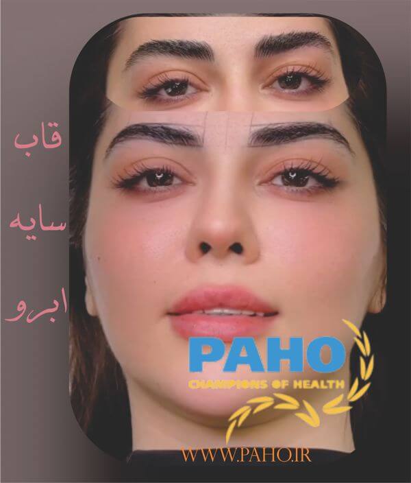 قاب و سایه ابرو