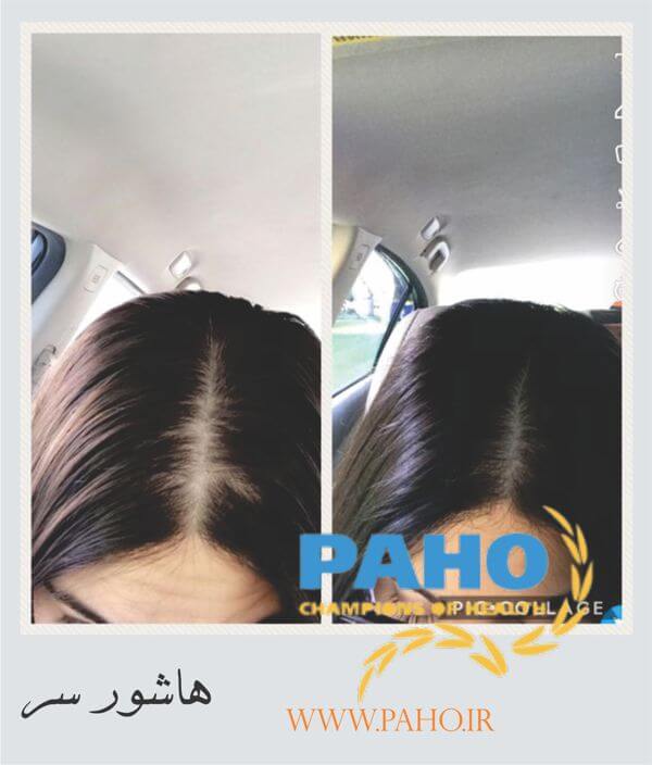 هاشور سر