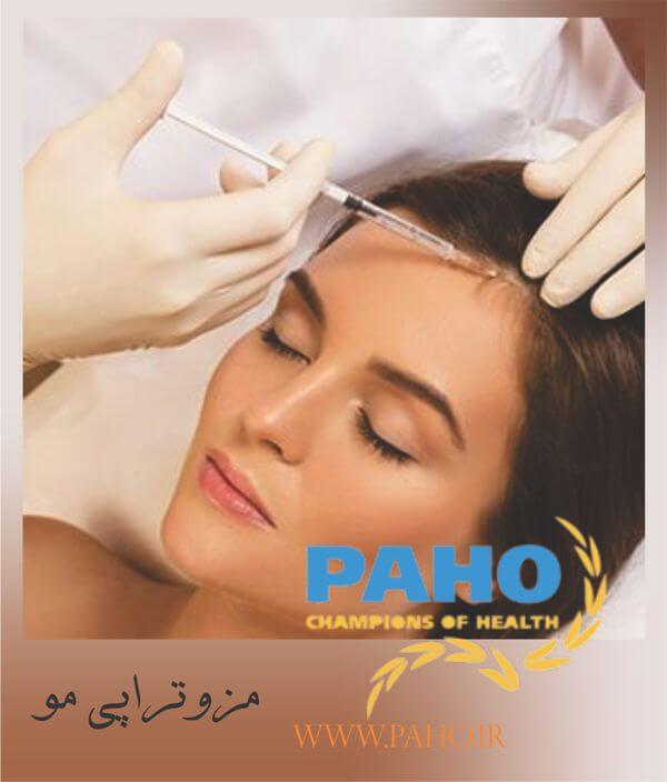مزوتراپی مو