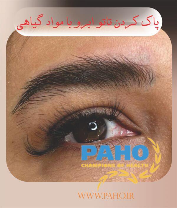 پاک کردن تاتو با مواد گیاهی