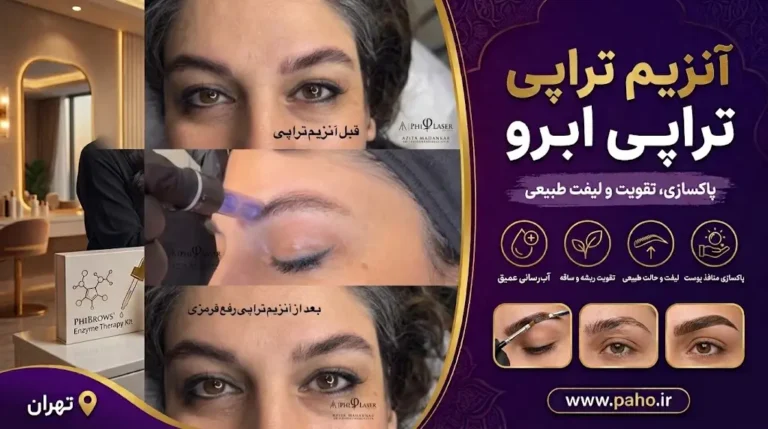 آنزیم تراپی ابرو چیست ؟ و چه مزایایی دارد ؟