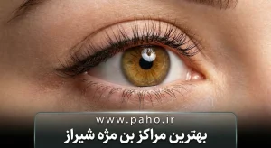 بن مژه در شیراز