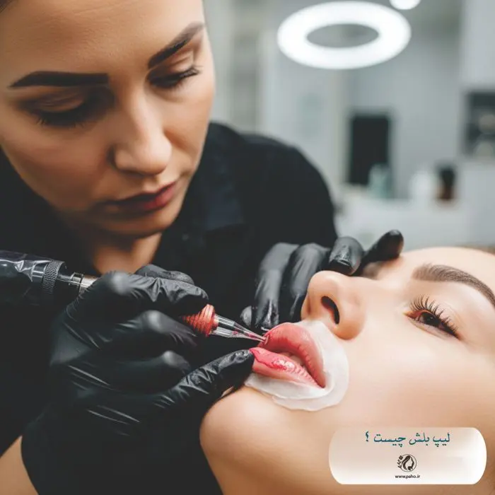 لیپ بلش چیست ؟