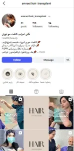 بهترین کلینیک کاشت مو در تهران