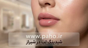 شیدینگ لب در شیراز