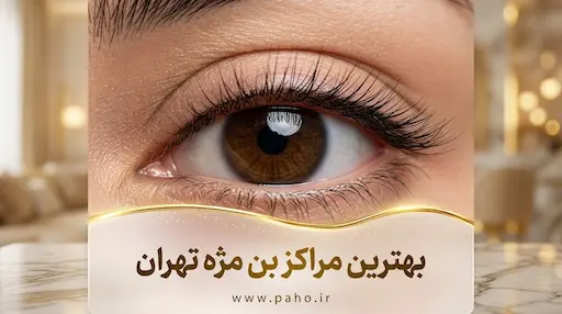 بهترین بن مژه کار در تهران