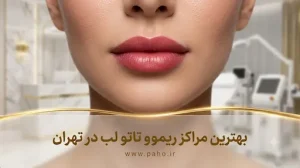 بهترین مرکز پاک کردن تاتو لب در تهران (هزینه + معرفی کلینیک‌ها)