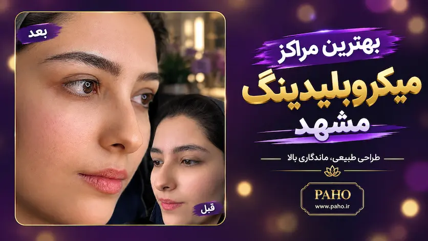 میکروبلیدینگ ابرو در مشهد - اجرای خطوط مویی با قلم بلید