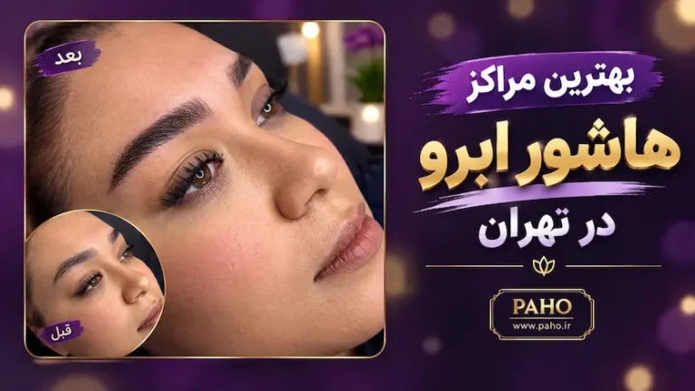 هاشور ابرو تهران