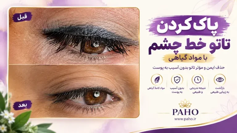 پاک کردن تاتو خط چشم