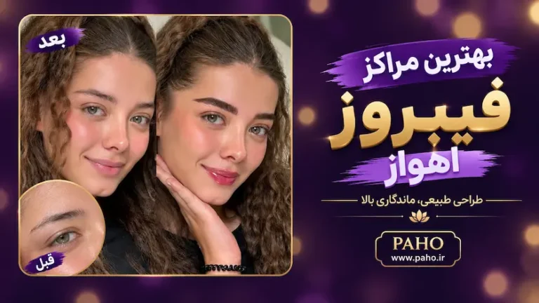 فیبروز ابرو در اهواز