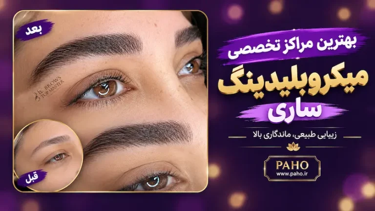 میکروبلیدینگ تخصصی در ساری