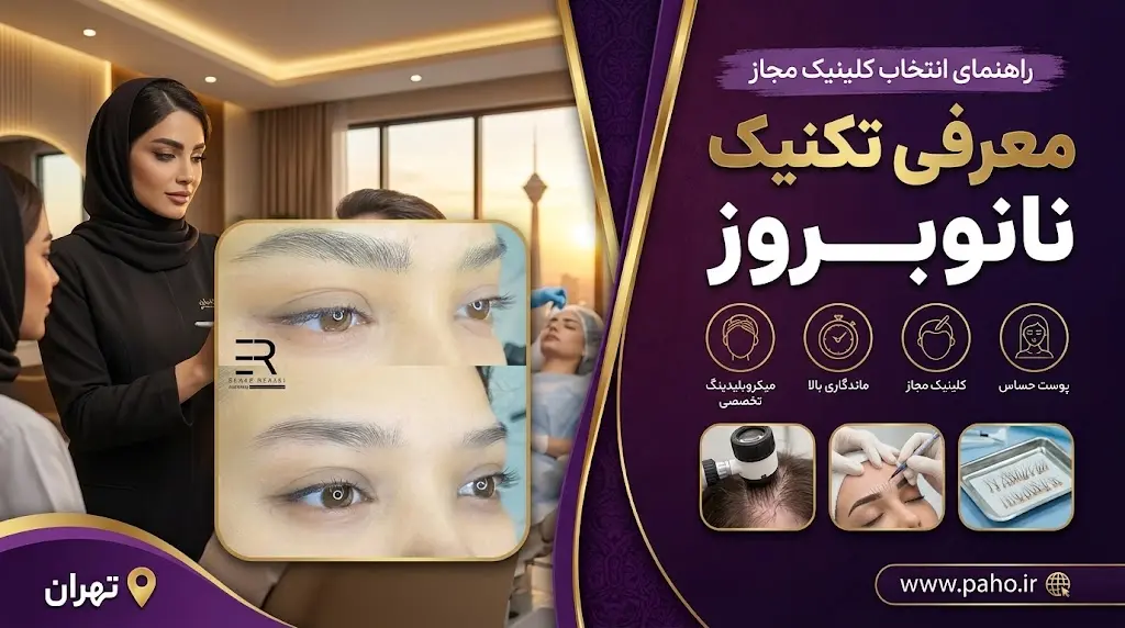 نانو بروز ابرو