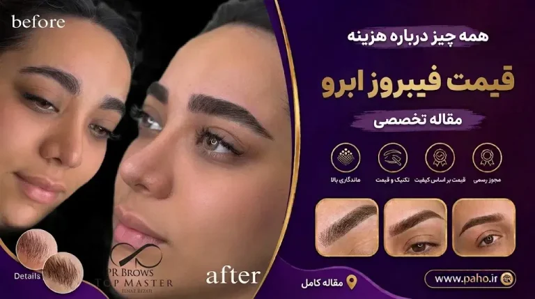 هزینه فیبروز ابرو در ۱۴۰۵